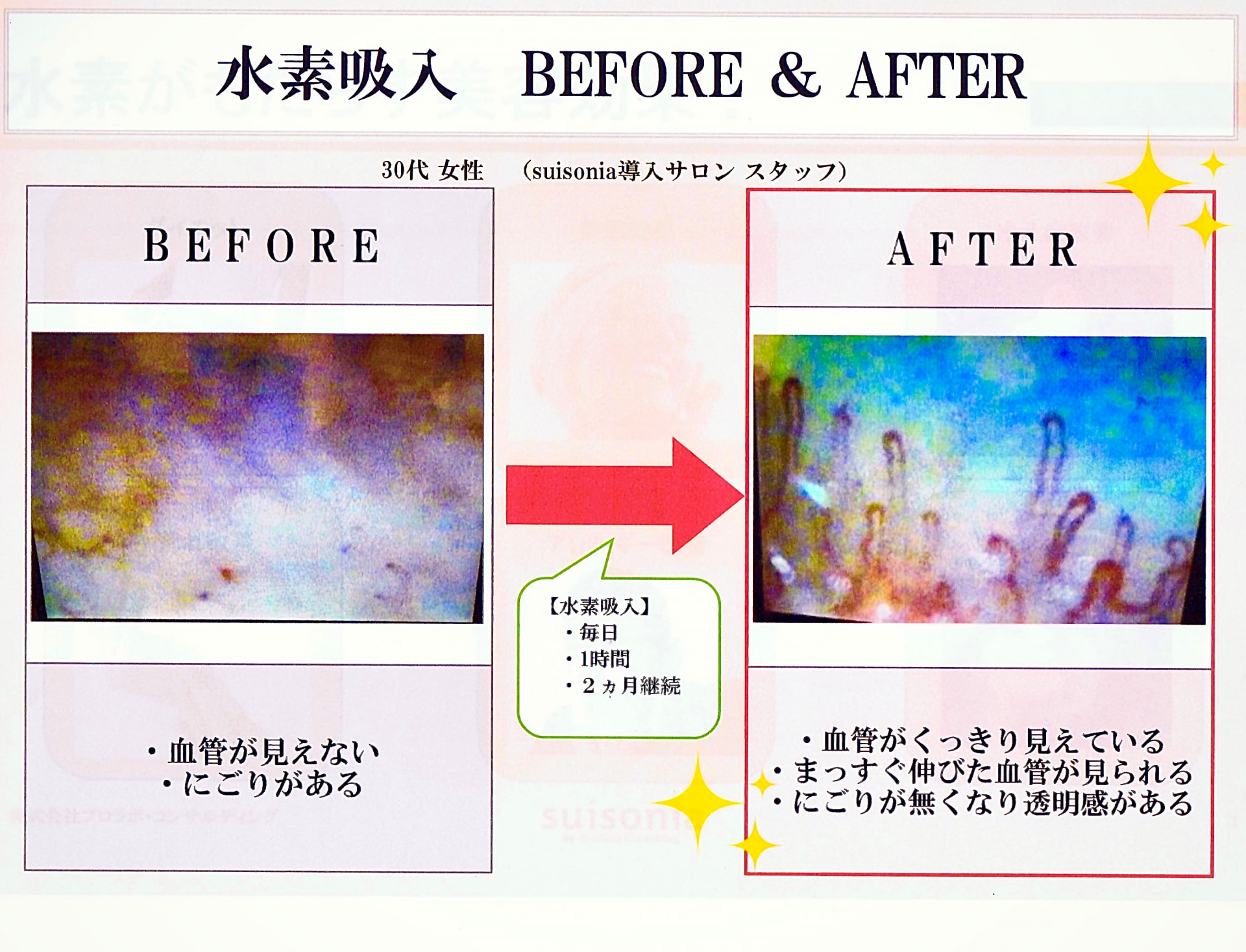 image1 image1